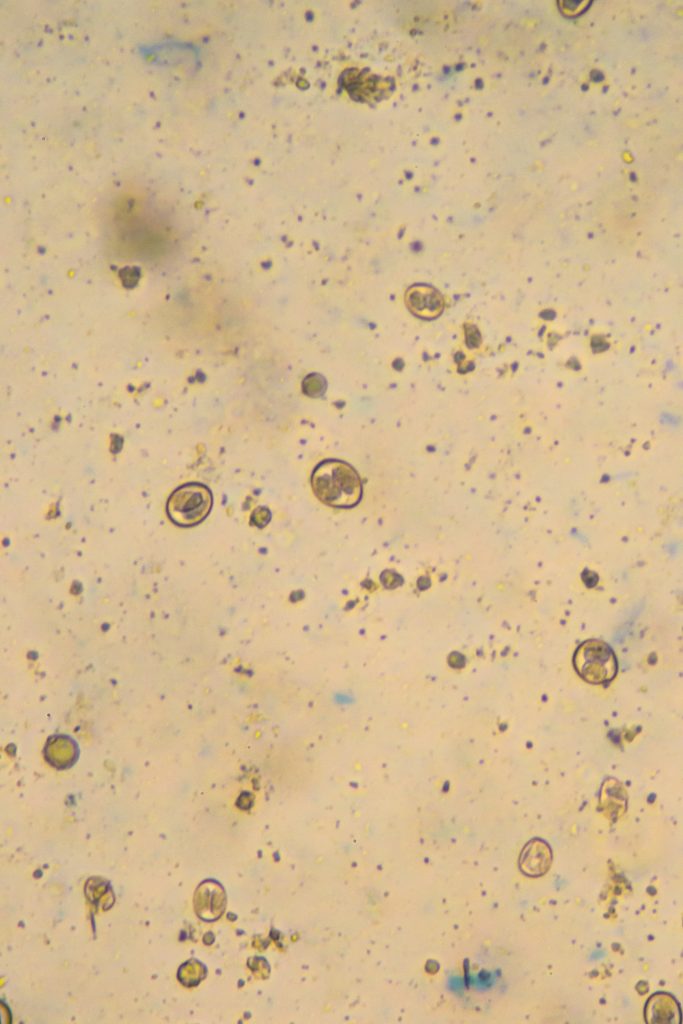 sporulated,oocysts,of,eimeria/isospora,isolated,from,infected,samples,of,a